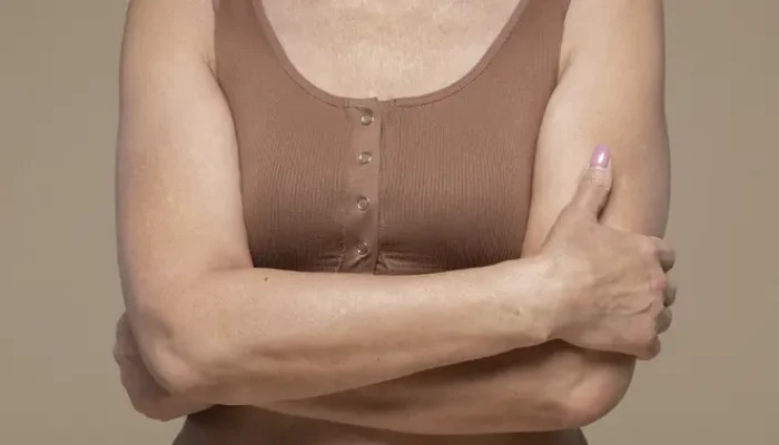 Pentingnya Merawat Lipatan Tubuh untuk Kesehatan Kulit