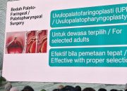 Mendengkur Bukan Pertanda Tidur Nyenyak Menurut Dokter