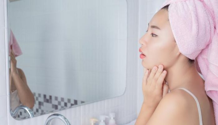 Jerawat Hormonal Penyebab dan Solusi Mengatasi Tanpa Bekas