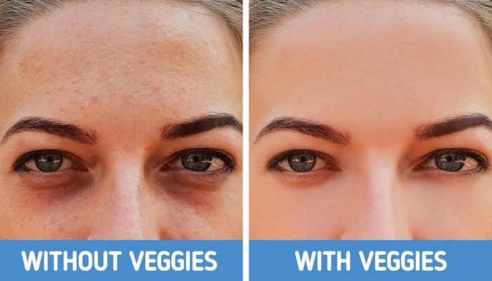 4 Jenis Lingkaran Hitam di Bawah Mata dan Cara Mengatasinya dengan Tepat