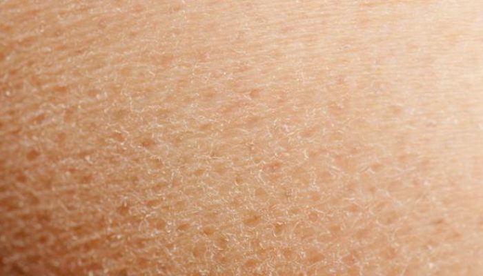 7 Bahan Alami untuk Mengatasi Kulit Kering dari Dapur yang Mudah Didapatkan